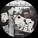 KENNETH JAMES G / YOUR CONDITION